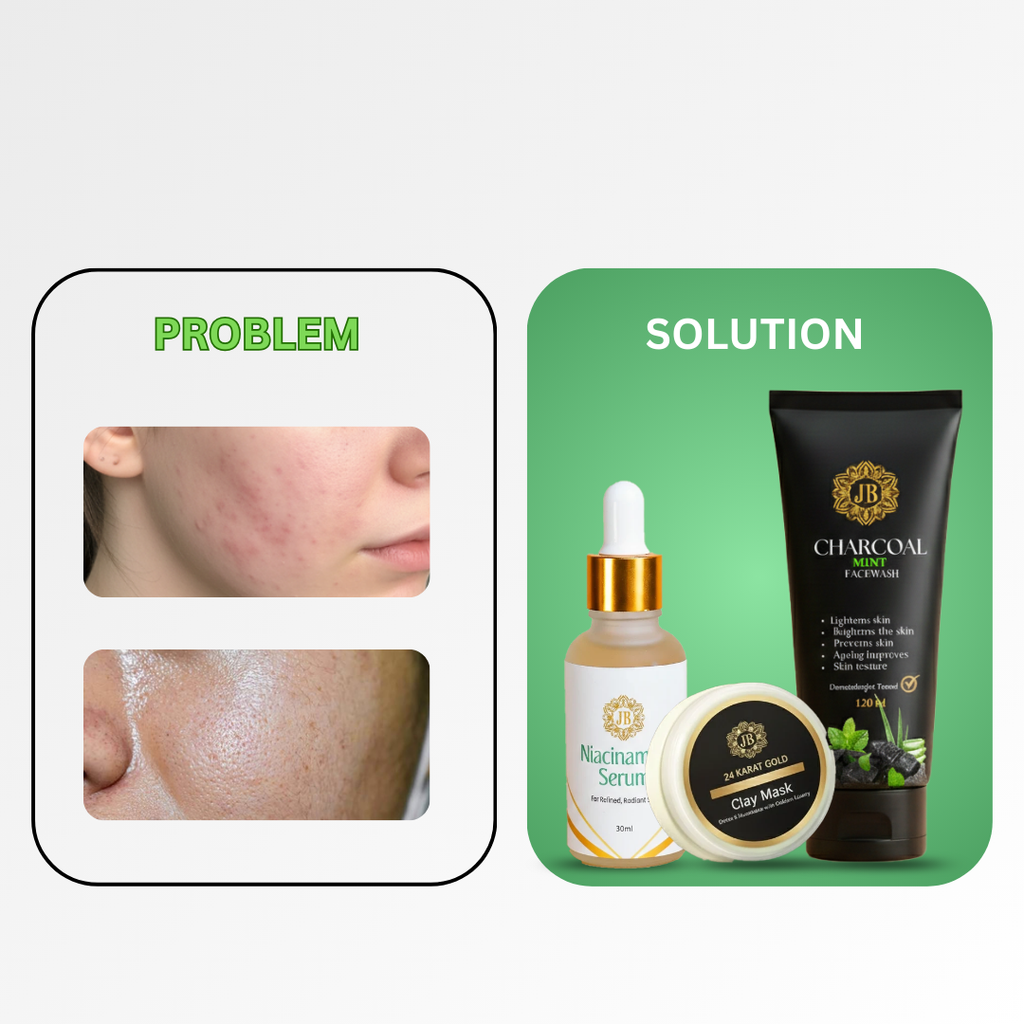 Acne Control In Just 7 Days
