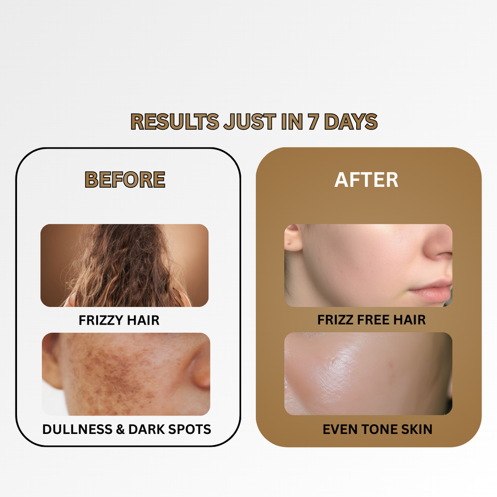 No More Hair & SKin Problem